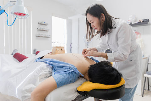 Acupuncture for headaches and migraines at Yi Acupuncture Orlando FL