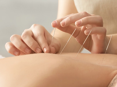 Acupuncture scar treatment therapy to reduce scar tissue and improve range of motion