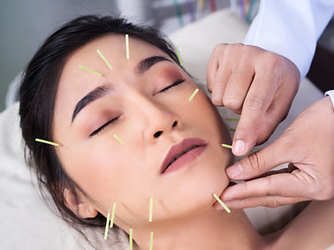 Cosmetic acupuncture for facial rejuvenation and post-surgery recovery